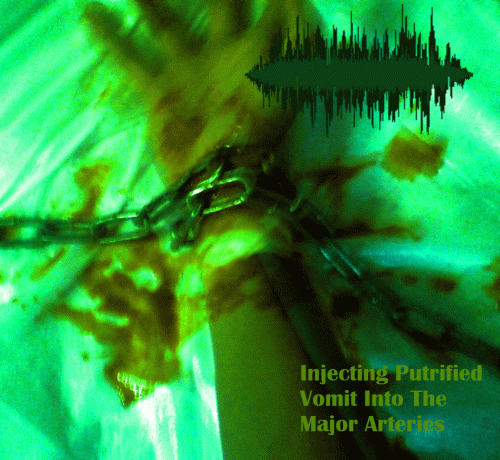 Dezkarga : Injecting Putrefied Vomit Into the Major Arteries Dezkarga : Injecting Putrefied Vomit Into the Major Arteries